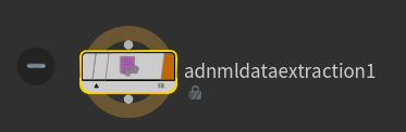 AdnMLDataExtraction TOP HDA node